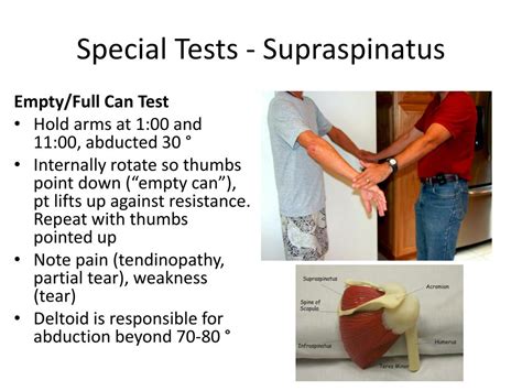 shoulder supraspinatus test